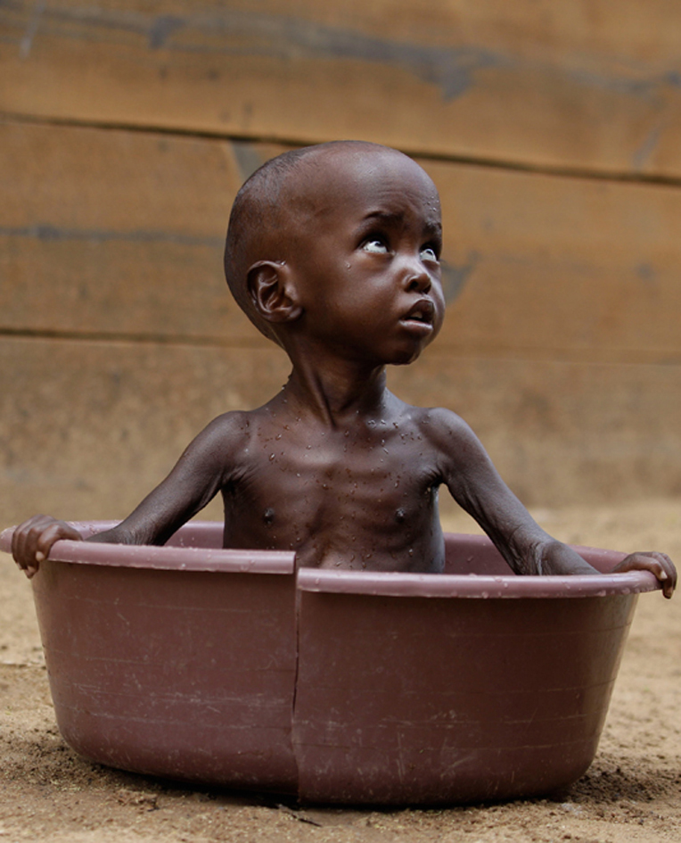 ?frica: "? Beira de Uma Crise Humanit?ria" foto: Rebecca Blackwell / Associated Press)